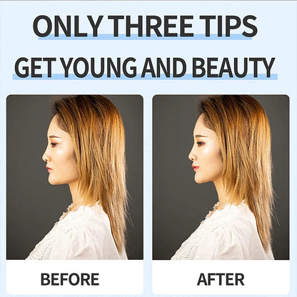 Tiokkss Face Lift Tapes and Bands, Facelift Bands with Clips, Face Lift Tapes and Bands with Clip(Double Belt, Beige)